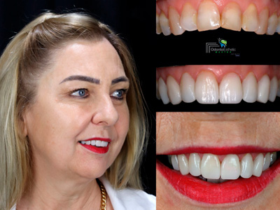 Estética Dental Ijuí RS