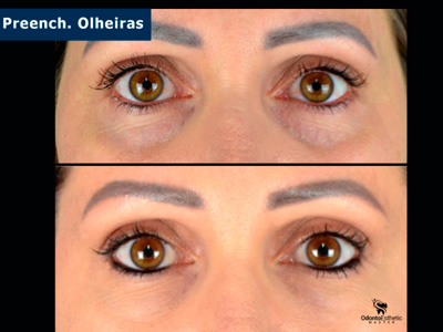 Harmonização Orofacial Ijuí RS