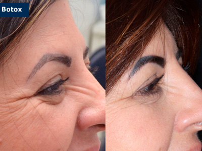 Harmonização Orofacial Ijuí RS