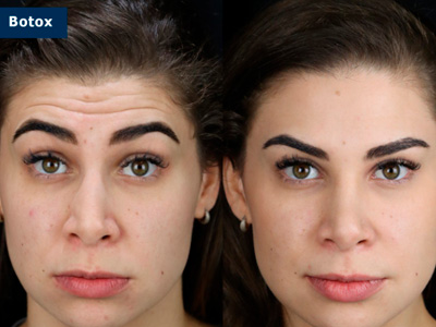 Harmonização Orofacial Ijuí RS